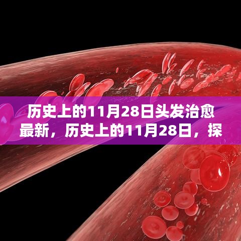 歷史上的11月28日，探尋頭發(fā)治愈的最新篇章??