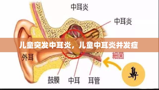 兒童突發(fā)中耳炎，兒童中耳炎并發(fā)癥 